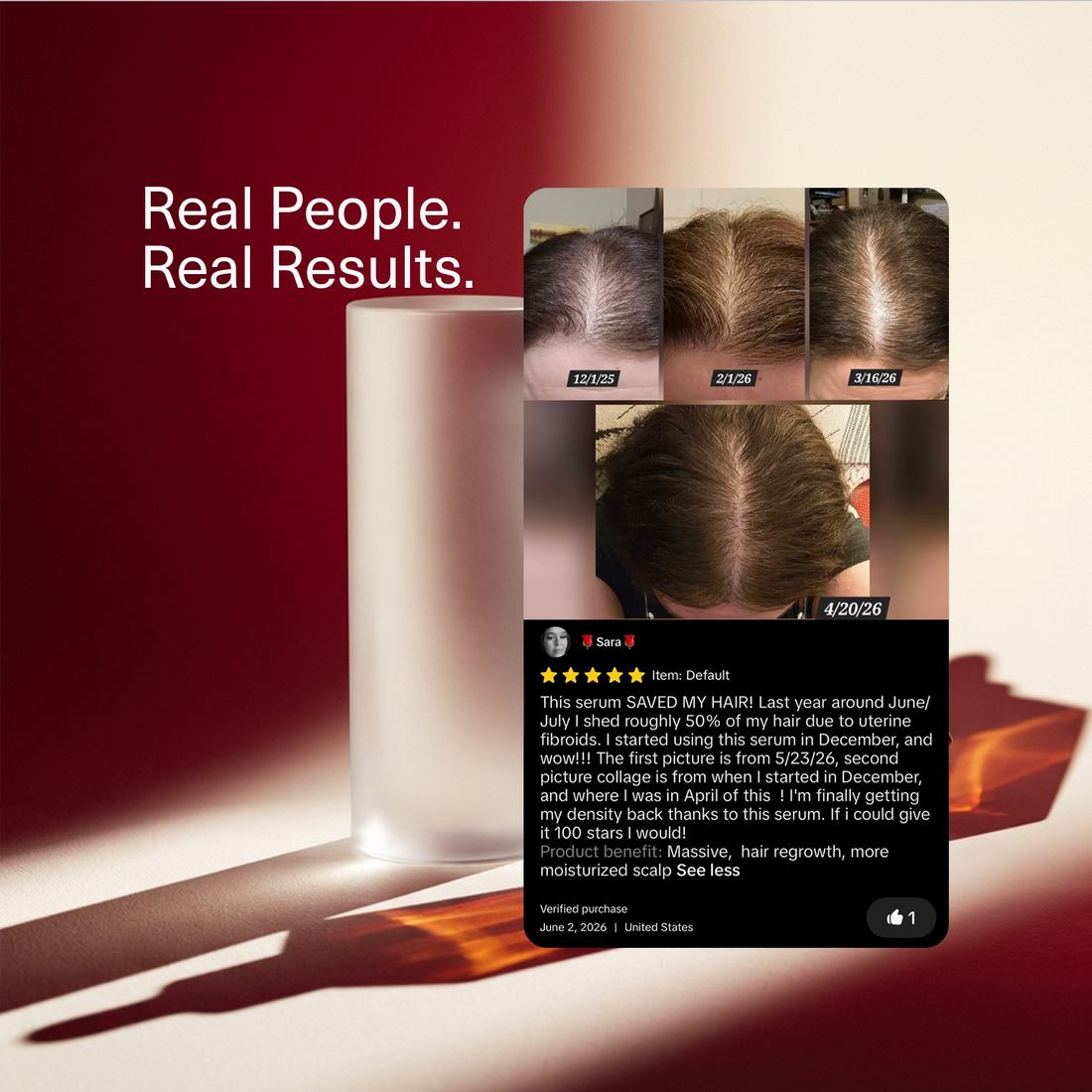 Real people, real results: a Bloom customer's dated hair part photos from December 2025 to April 2026 with her five-star review. Individual results may vary.